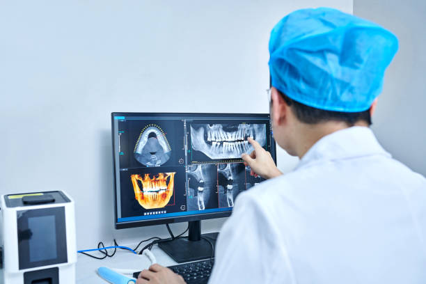 Best Knocked-Out Tooth (Avulsed Tooth) Treatment in Sierra Ridge, CO
